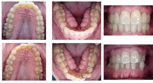 DR. Justin Moseley. Preston Commons Dental Care. General, Cosmetic, Restorative, Preventative Dentistry Dentist in Dallas TX 752253