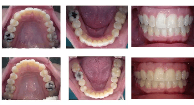 DR. Justin Moseley. Preston Commons Dental Care. General, Cosmetic, Restorative, Preventative Dentistry Dentist in Dallas TX 752253