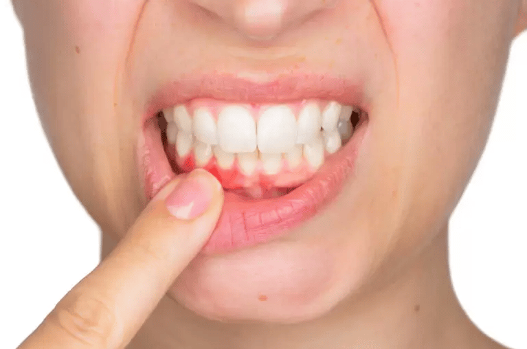 person with gum disease